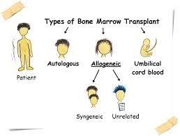 Types of bone marrow transplants