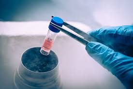 Frozen Embryo Transfer – Encino, CA ...