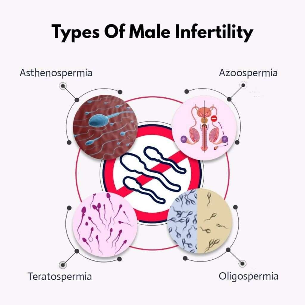 Different Types of Male Infertility