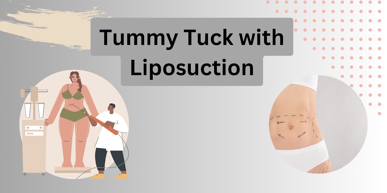 Mini Tummy Tuck Surgery Service at best price in Ahmedabad