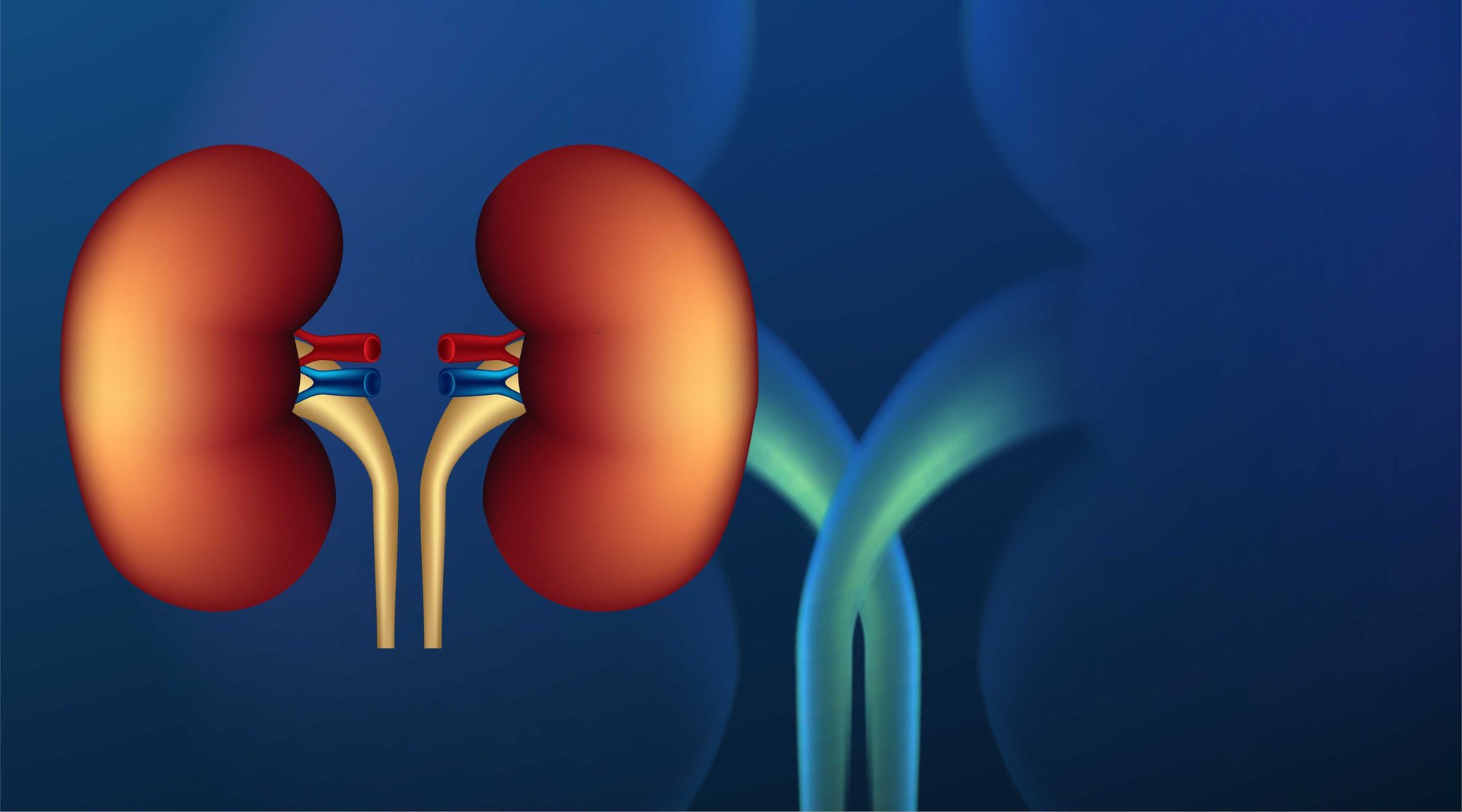 Kidney Failure