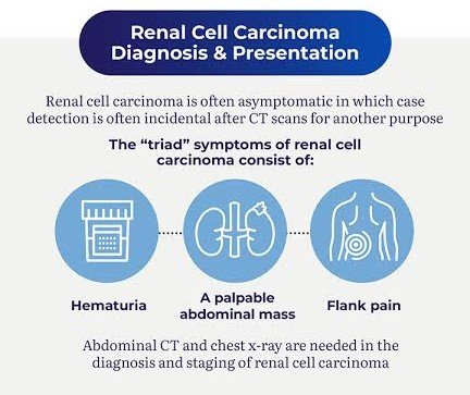 How Is Renal Cancer Metastasis to the Lungs Diagnosed?