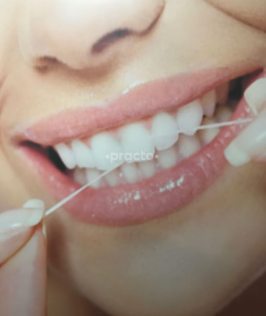 Why It's Easier To Fail With orthodontic treatment Dwarka Than You Might Think