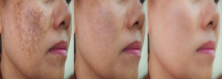 Kaya Clinic in Banjara HillsHyderabad  Best Skin Care Clinics in  Hyderabad  Justdial