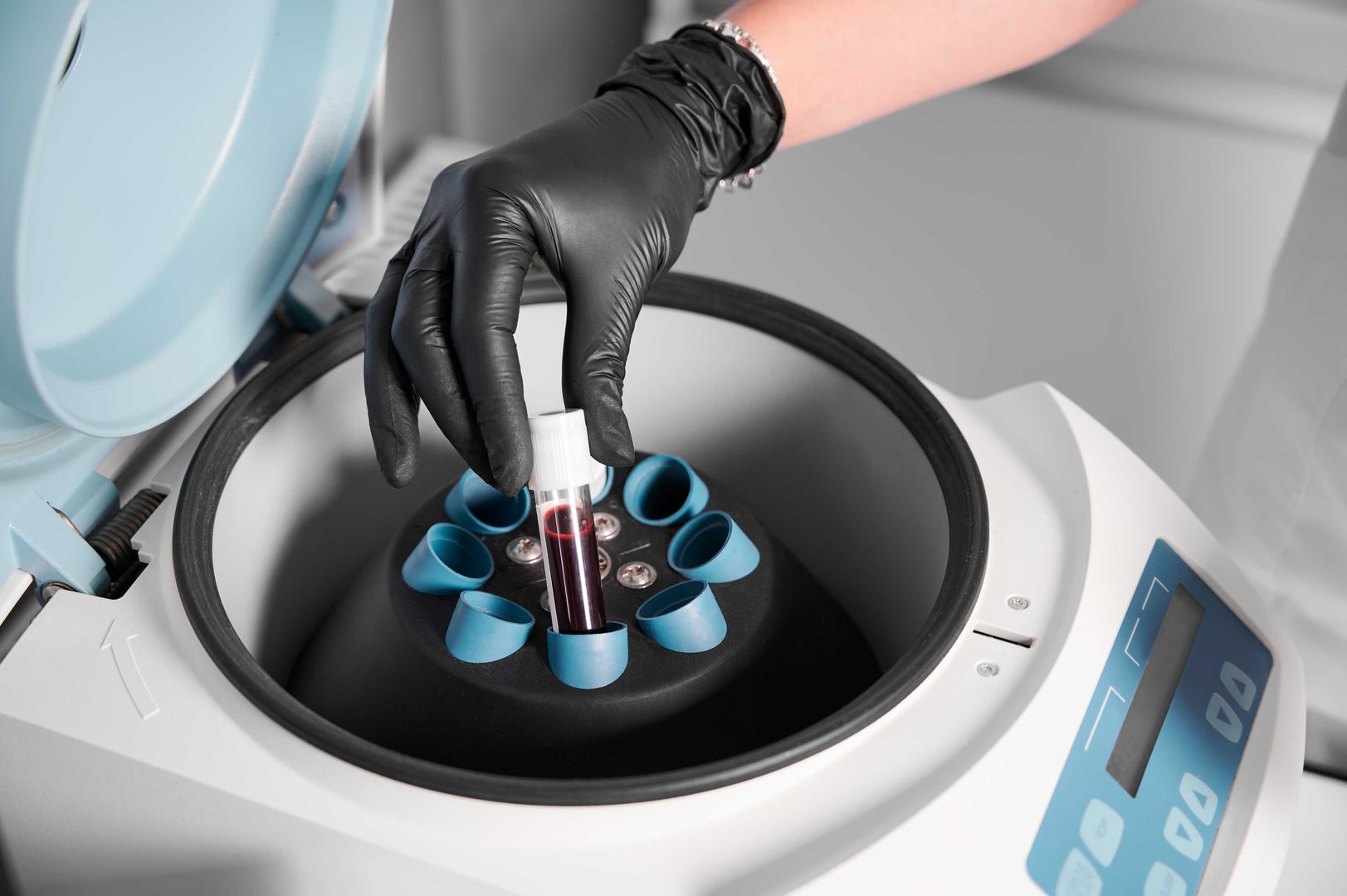 Stem cell treatment