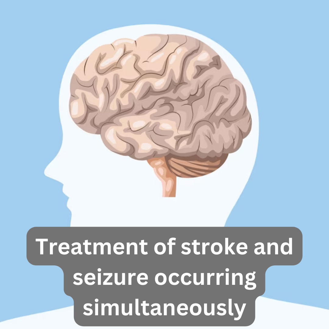 Treatment of stroke and seizure occurring simultaneously