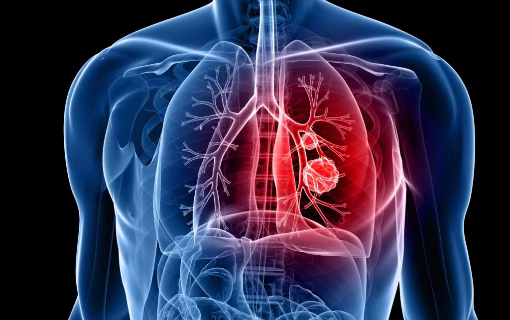 Thoracic Surgeon