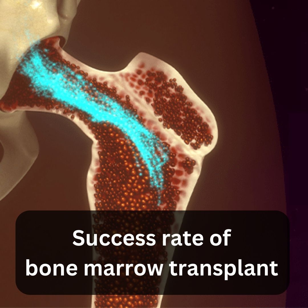 bone marrow transplant success rate