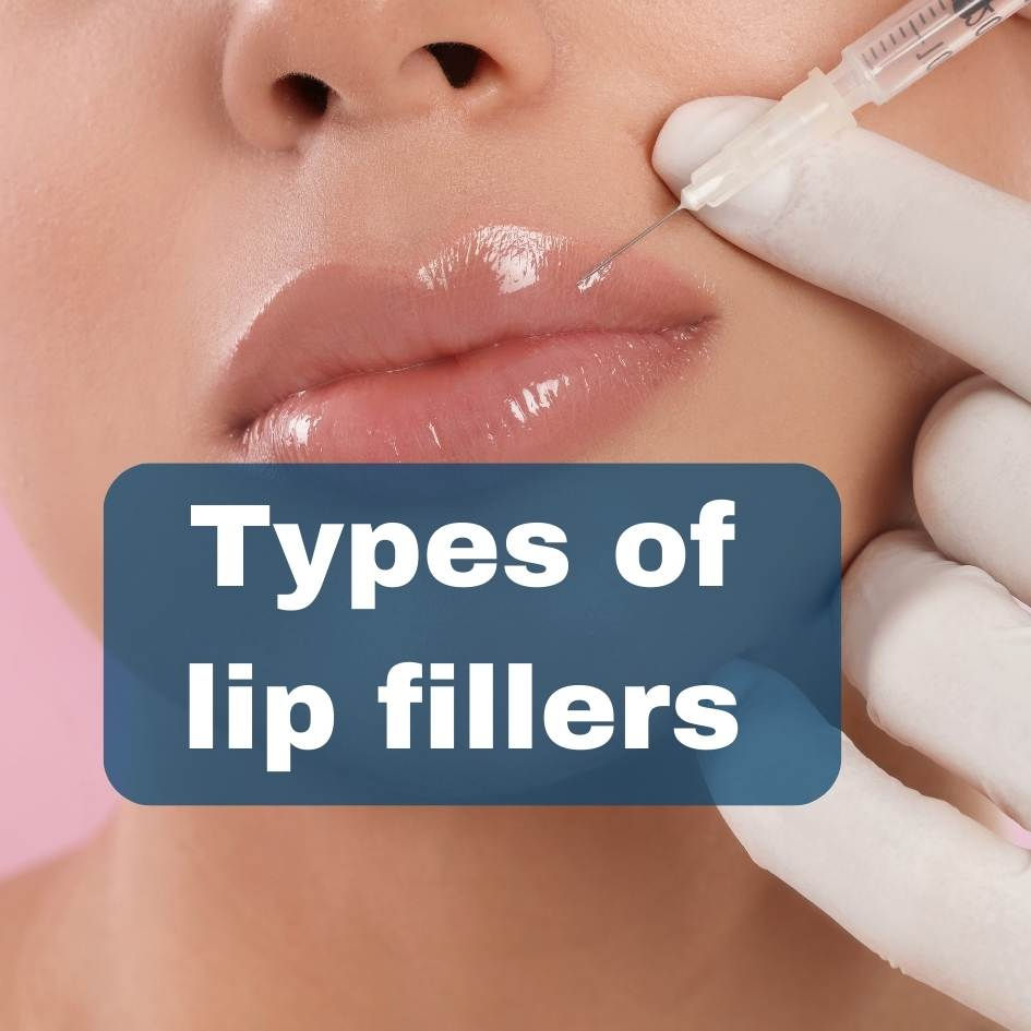 Type of lip filler