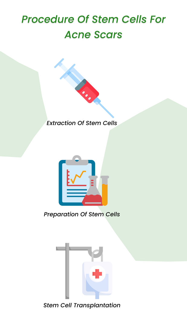 Procedure of stem cell for acne scars