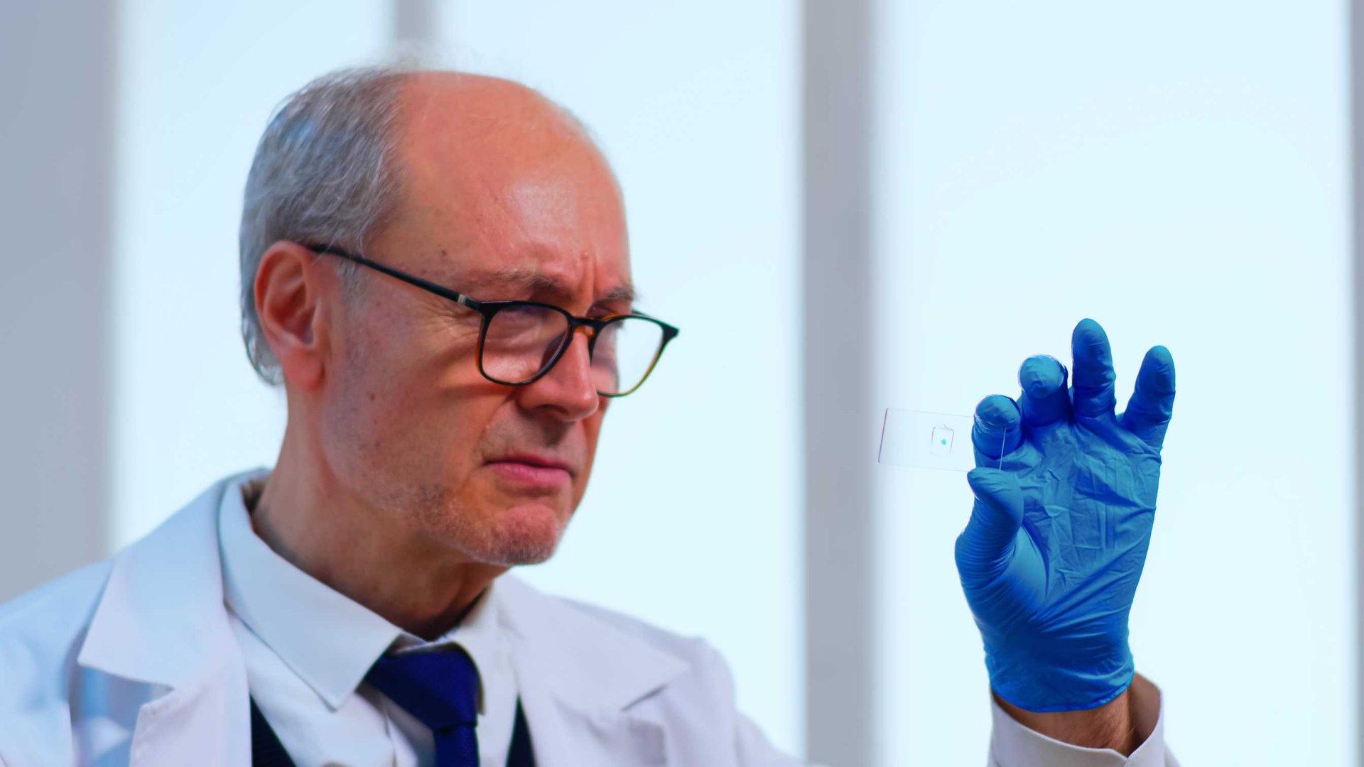 Prostate Cancer