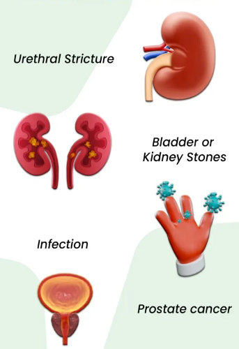 Causes of blood in urine 3 months after TURP