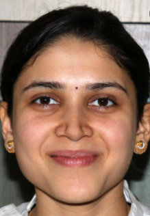 Dr. Sumini Nema