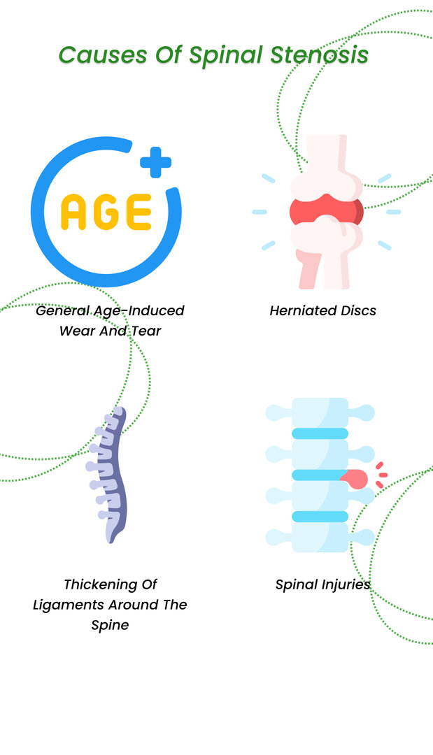 Causes of spinal stenosis