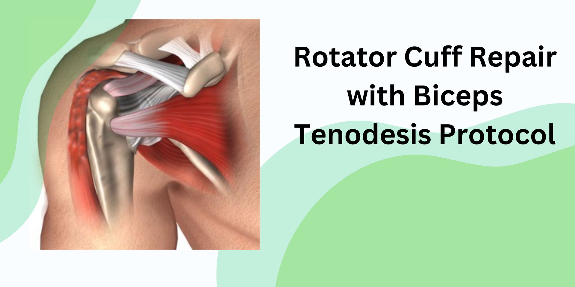 Rotator Cuff Repair with Biceps Tenodesis Protocol