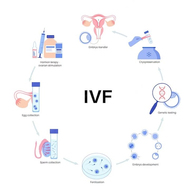 IVF