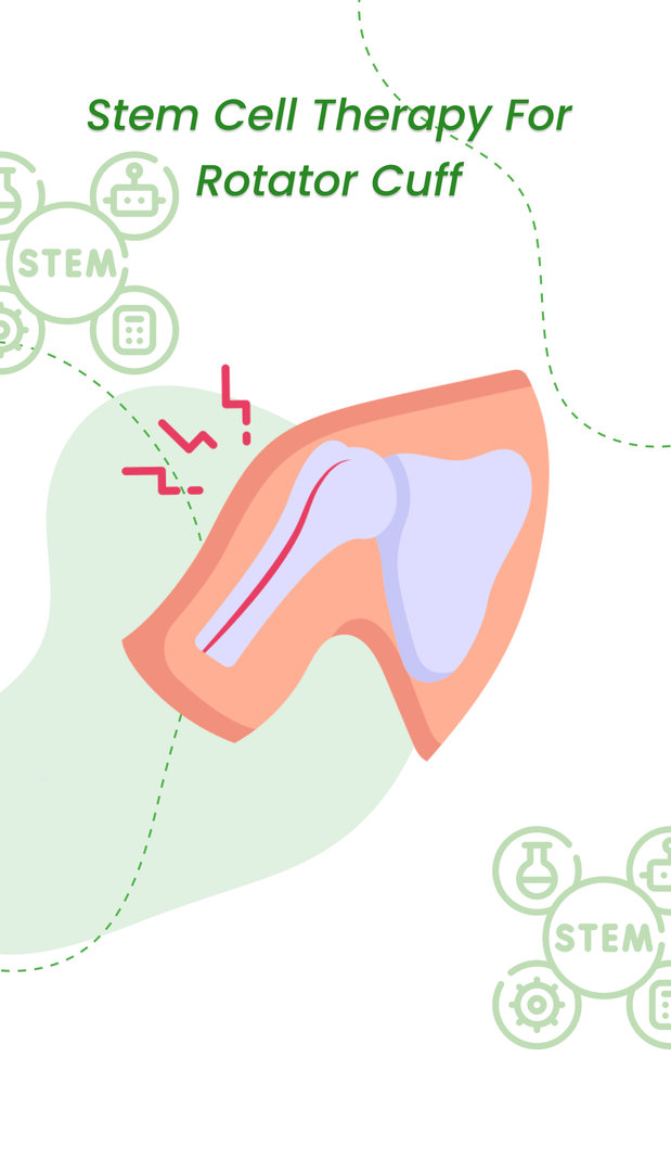 Stem cell therapy for rotator cuff