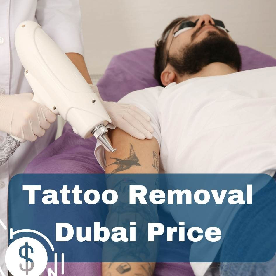 Tattoo removal price