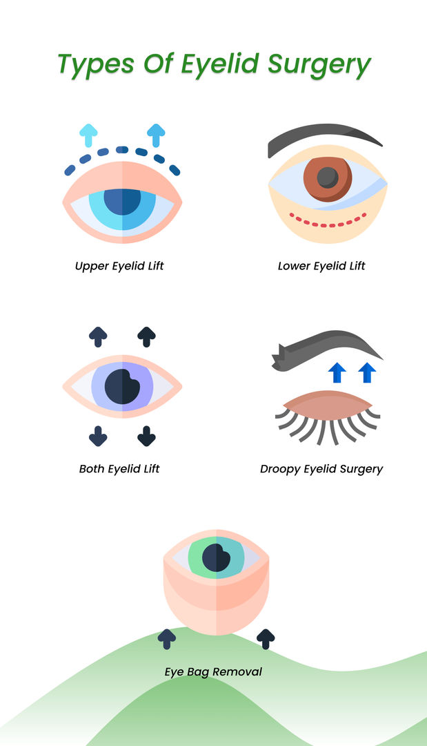 Types of eyelid surgery