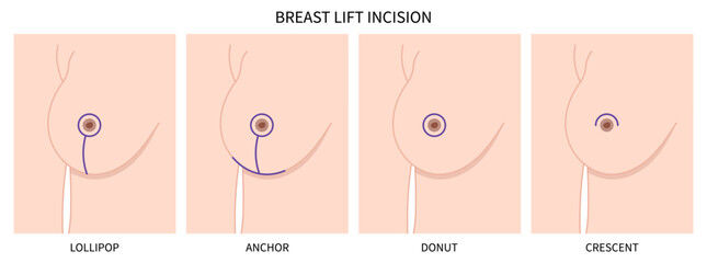 types of breast lift turkey