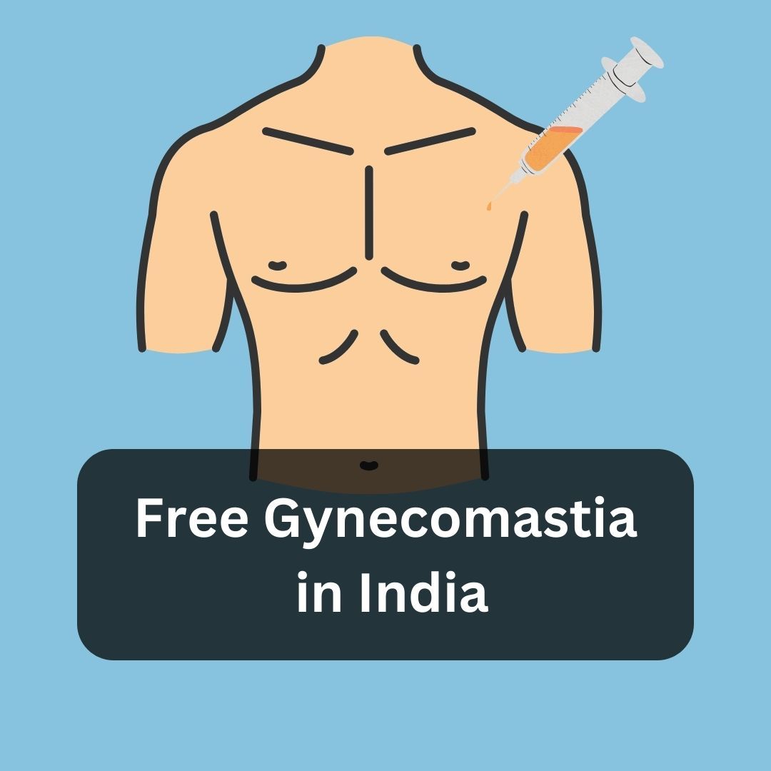 Free gynecomastia surgery in India