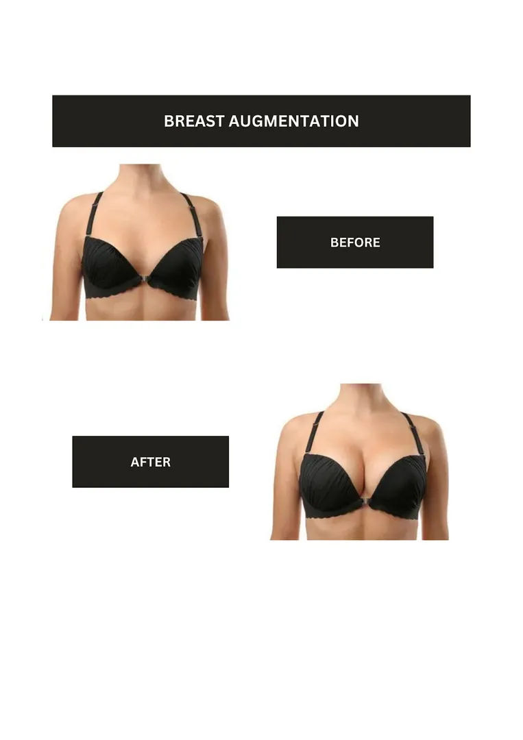boob job before/after results
