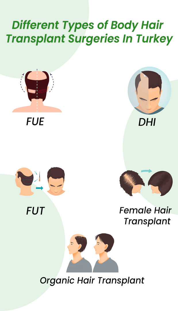 Different types of body hair transplant turkey