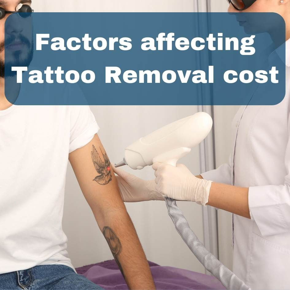 Factors That Influence Laser Tattoo Removal Cost Jupiter FL