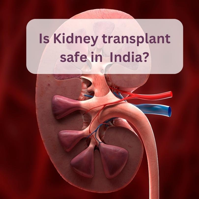 Is kidney transplant in India safe? 