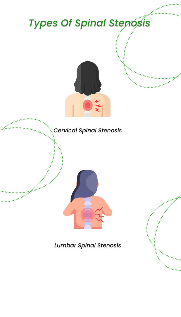 Types of spinal stenosis