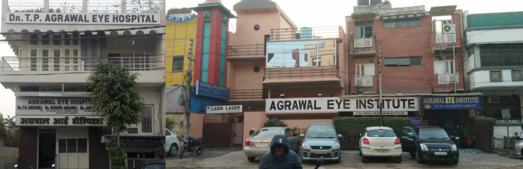 Agrawal Eye Institute