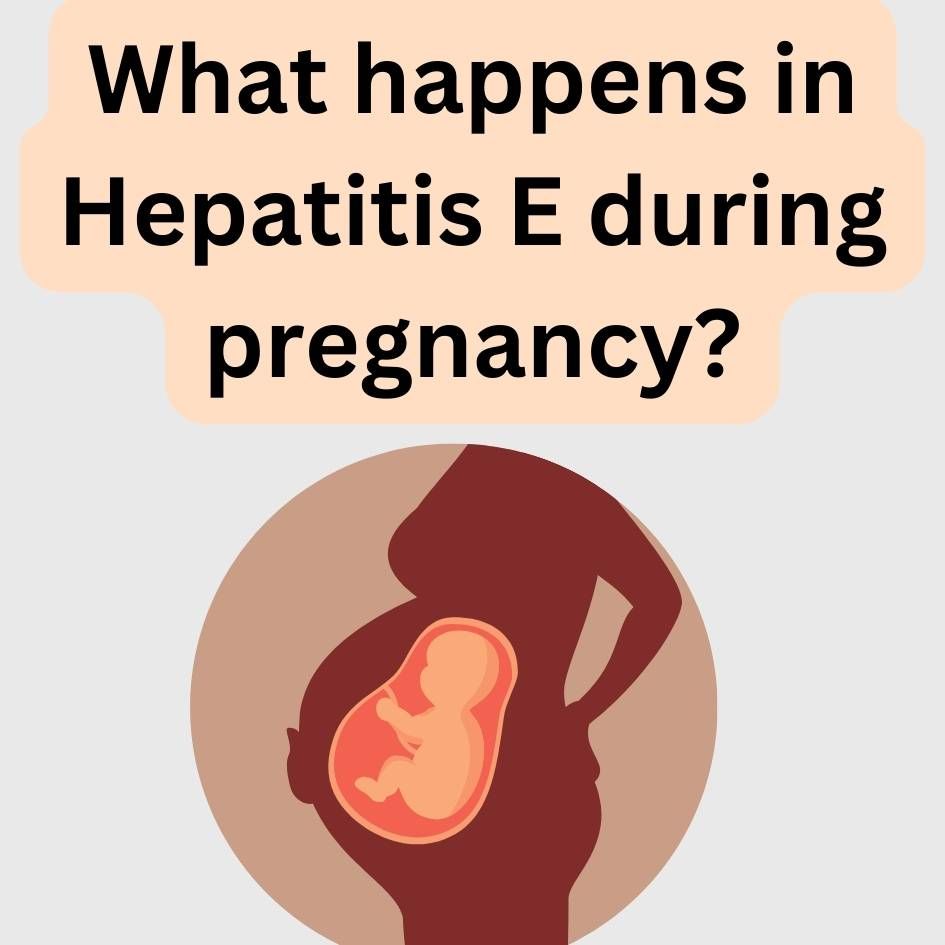 What happens if you have Hepatitis E during pregnancy?