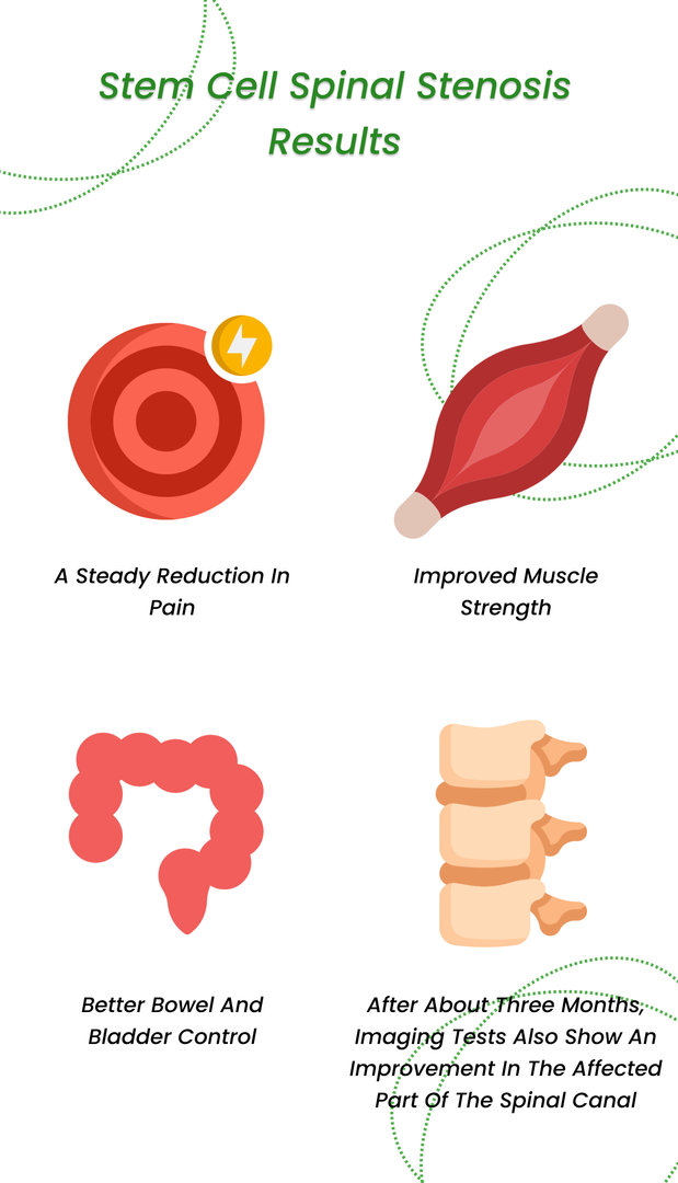 Stem cell spinal stenosis results