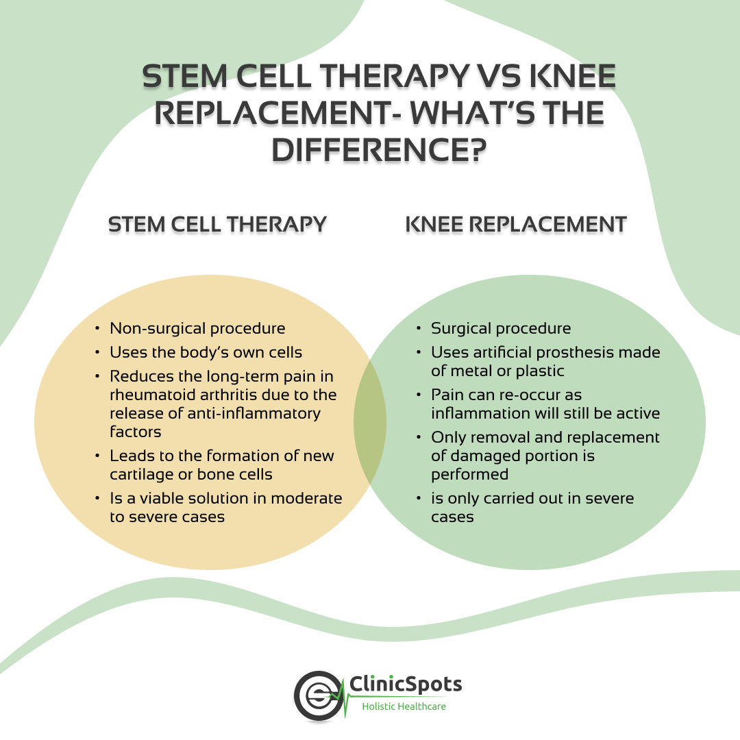 Stem cell vs knee replacement