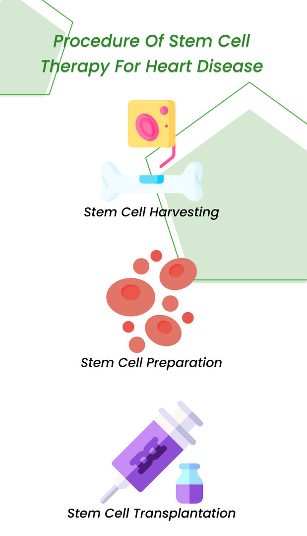 Procedure of stem cell therapy for heart disease