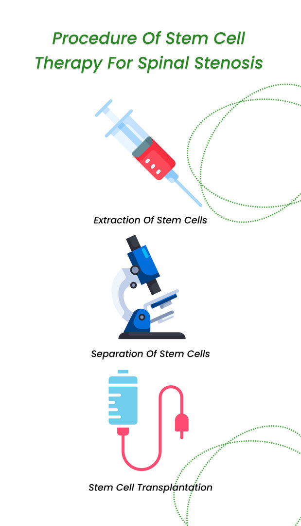 Procedure of stem cell therapy for spinal stenosis