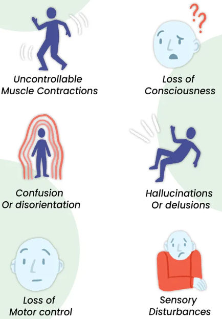 Symptoms of seizures after Brain Surgery