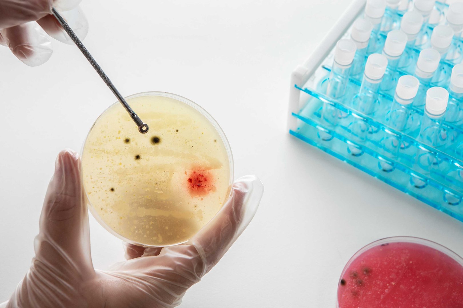 Stem cell collection