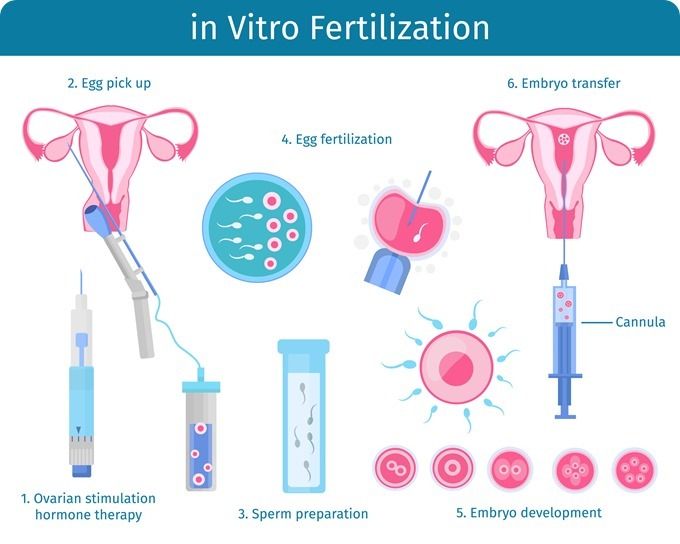 The Role of Estrace (Estradiol) in IVF