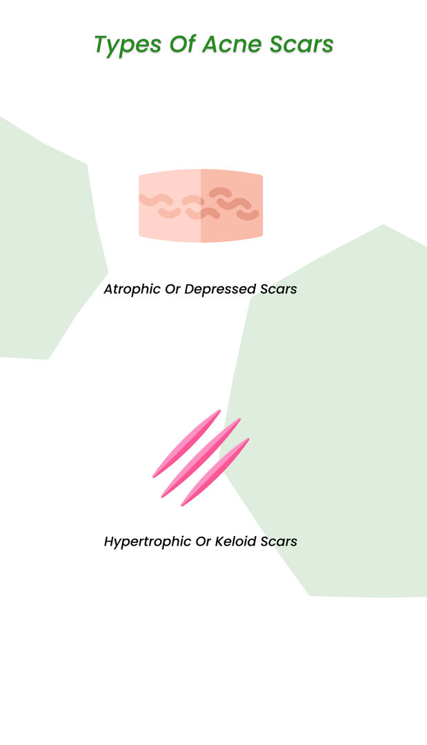 types of acne scars treated with stem cells