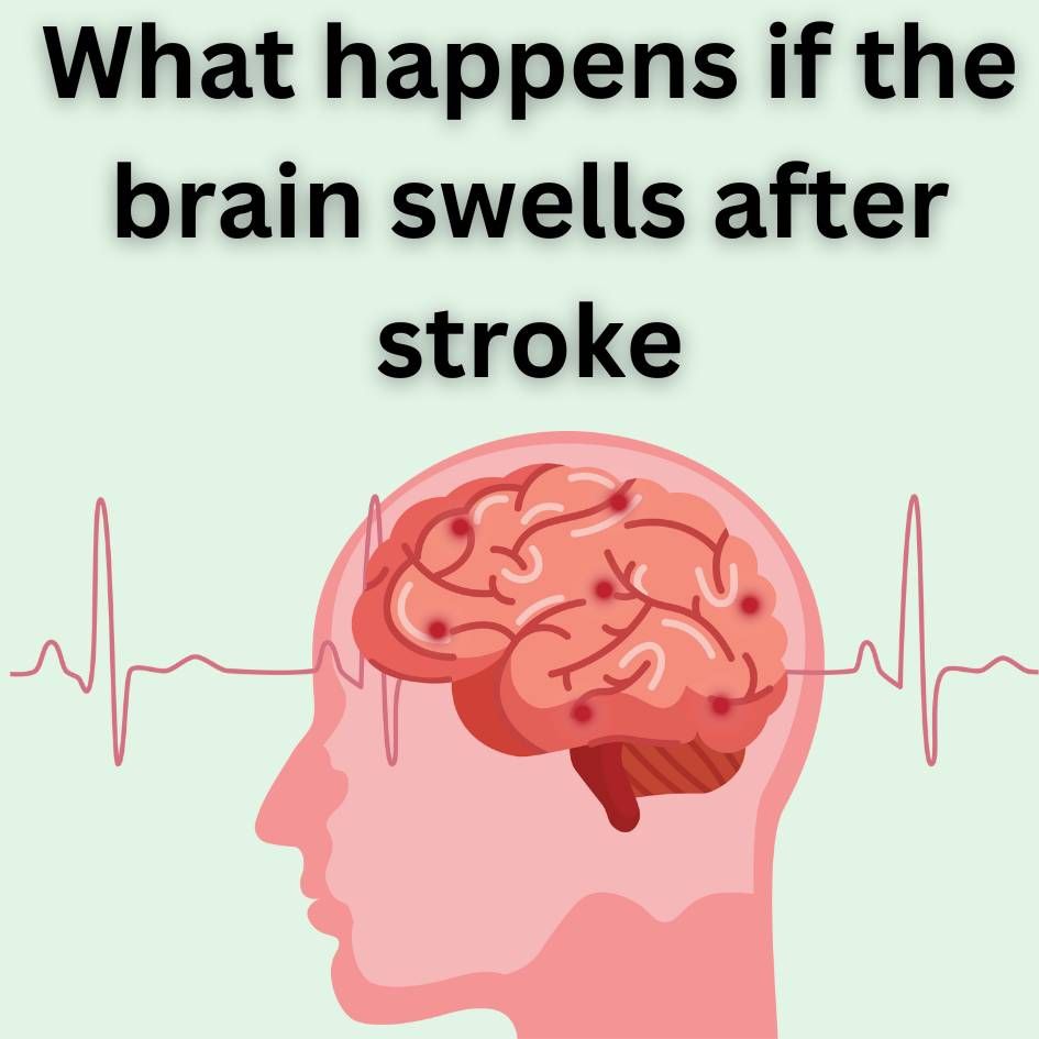 What happens if the brain swells after stroke?