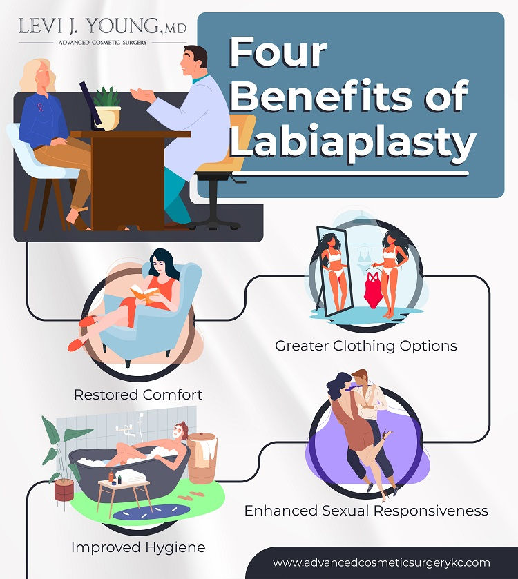 benefits of labiaplasty