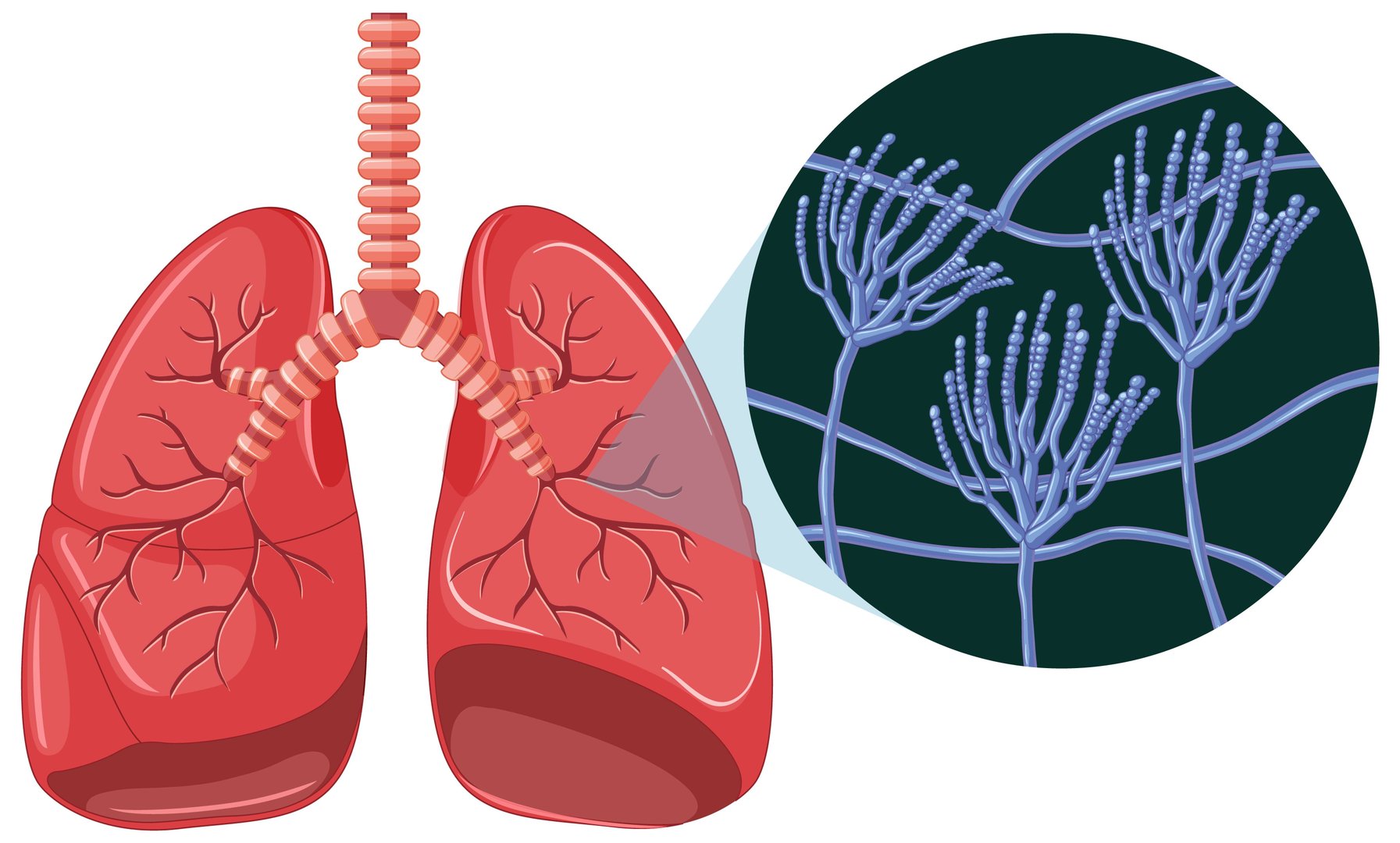 Stem Cell Treatment for Lungs