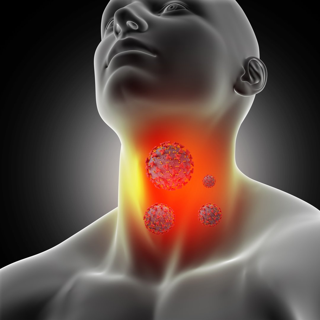 Hashimoto's Disease