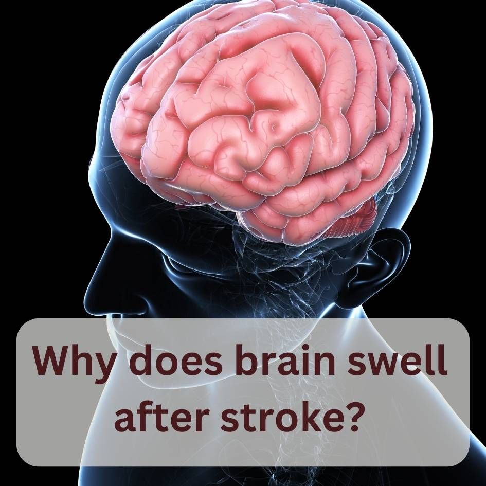Why does the brain swell after the stroke?