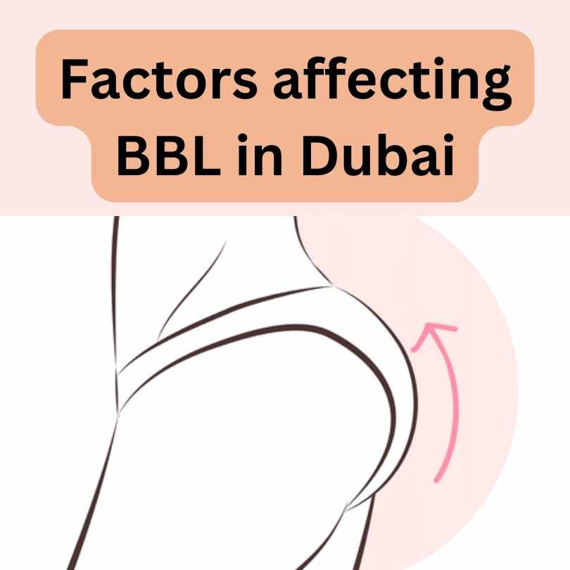 Factors affectinhg BBL cost