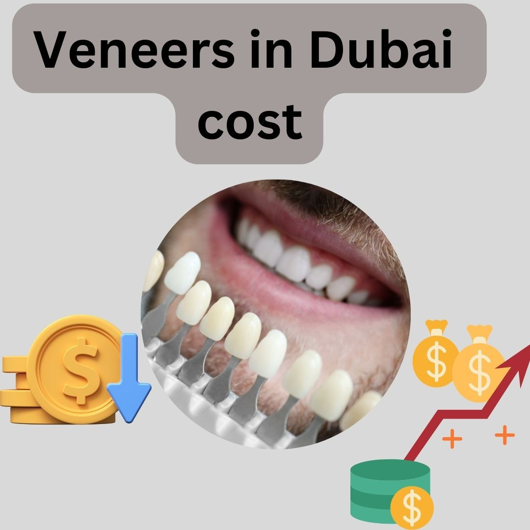 Veneers cost in Dubai