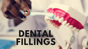 dental fillings