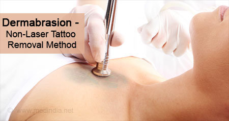 Dermabrasion: