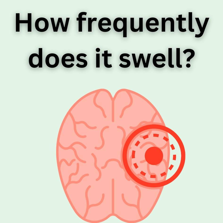 How frequently does swelling in brain  due to stroke occur? 